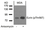 Phospho-Ezrin (Thr567) Antibody in Western Blot (WB)