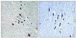 Phospho-SF1 (Ser82) Polyclonal Antibody