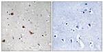 Phospho-IKK gamma (Ser376) Polyclonal Antibody