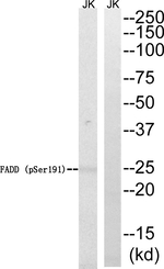 Phospho-FADD (Ser191) Antibody in Western Blot (WB)
