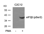 Phospho-eIF2 beta (Ser2) Polyclonal Antibody