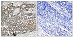 Phospho-DOK2 (Tyr299) Antibody in Immunohistochemistry (Paraffin) (IHC (P))
