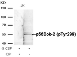 Phospho-DOK2 (Tyr299) Antibody in Western Blot (WB)