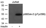 Phospho-DOK2 (Tyr299) Antibody in Western Blot (WB)