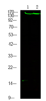 Phospho-ROCK2 (Tyr722) Antibody in Western Blot (WB)