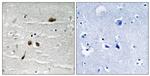 Phospho-MDC1 (Ser513) Polyclonal Antibody