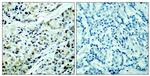 Phospho-HDAC5 (Ser498) Polyclonal Antibody