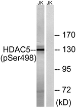 Phospho-HDAC5 (Ser498) Antibody in Western Blot (WB)