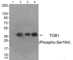 Phospho-TOB1 (Ser164) Antibody in Western Blot (WB)