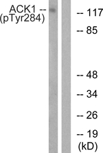 Phospho-ACK1 (Tyr284) Antibody in Western Blot (WB)
