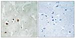 Phospho-TIP60 (Ser90) Antibody in Immunohistochemistry (Paraffin) (IHC (P))