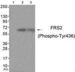 Phospho-FRS2 (Tyr436) Antibody in Western Blot (WB)