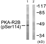 Phospho-PRKAR2B (Ser114) Polyclonal Antibody