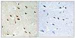 Phospho-GRF-1 (Tyr1105) Polyclonal Antibody