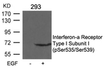 Phospho-IFNAR1 (Ser535, Ser539) Antibody in Western Blot (WB)
