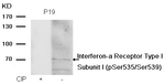 Phospho-IFNAR1 (Ser535, Ser539) Polyclonal Antibody