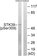 Phospho-STK39 (Ser309) Antibody in Western Blot (WB)