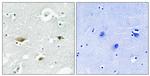 Phospho-STK39 (Ser323) Antibody in Immunohistochemistry (Paraffin) (IHC (P))