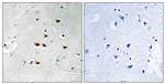 Phospho-ITCH (Tyr420) Polyclonal Antibody