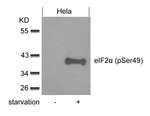 Phospho-EIF2S1 (Ser49) Antibody in Western Blot (WB)