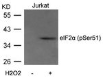 Phospho-EIF2S1 (Ser51) Antibody in Western Blot (WB)