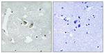 Phospho-p47phox (Ser345) Polyclonal Antibody