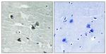 Phospho-MER/SKY (Tyr749, Tyr681) Antibody in Immunohistochemistry (Paraffin) (IHC (P))