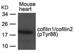 Phospho-Cofilin 1/2 (Tyr88) Antibody in Western Blot (WB)