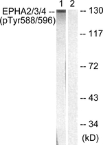Phospho-EphA2/EphA3/EphA4 (Tyr588, Tyr596) Antibody in Western Blot (WB)
