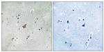 Phospho-EphA3/EphA4/EphA5 (Tyr779, Tyr833) Polyclonal Antibody