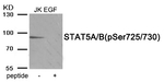 Phospho-STAT5 alpha/beta (Ser725, Ser730) Antibody in Western Blot (WB)