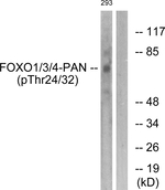 Phospho-FOXO1/FOXO3/FOXO4 (Thr24, Thr32) Polyclonal Antibody