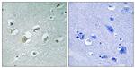 Phospho-MLK1/MLK2 (Thr312, Thr266) Polyclonal Antibody