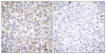 Phospho-AMPK alpha-1,2 (Thr183, Thr172) Antibody in Immunohistochemistry (Paraffin) (IHC (P))