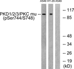 Phospho-PKD1/2/3/PKC mu (Ser738, Ser742) Antibody in Western Blot (WB)
