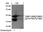 Phospho-JNK1/JNK2/JNK3 (Thr183, Tyr185) Antibody in Western Blot (WB)
