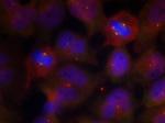 Phospho-Synaptotagmin 1/2 (Thr202, Thr199) Polyclonal Antibody