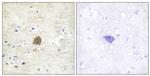Phospho-CaMKII alpha/beta/delta (Thr305) Polyclonal Antibody