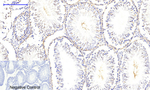 Phospho-CaMKII beta/gamma/delta (Thr287) Antibody in Immunohistochemistry (Paraffin) (IHC (P))