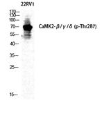Phospho-CaMKII beta/gamma/delta (Thr287) Antibody in Western Blot (WB)