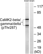 Phospho-CaMKII beta/gamma/delta (Thr287) Antibody in Western Blot (WB)