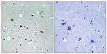 Phospho-LATS1/LATS2 (Thr1079, Thr1041) Polyclonal Antibody