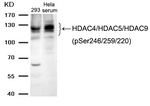 Phospho-HDAC4/HDAC5/HDAC9 (Ser246, Ser259, Ser220) Antibody in Western Blot (WB)
