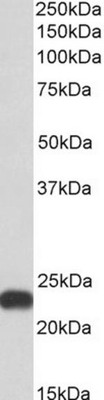 Flavin reductase Polyclonal Antibody