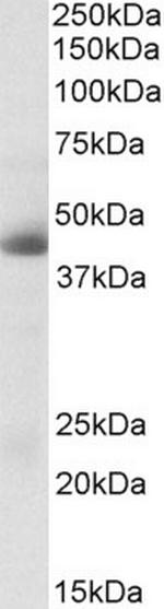 Carbonic Anhydrase XII Antibody in Western Blot (WB)