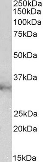 CLIC1 Antibody in Western Blot (WB)