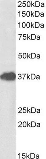 FOXF1 Polyclonal Antibody