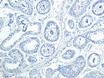 HOXA10 Polyclonal Antibody