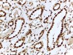 ILF3 Polyclonal Antibody