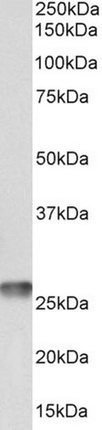 MT-ATP6 Polyclonal Antibody